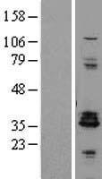 Proenkephalin / PENK Protein - Western validation with an anti-DDK antibody * L: Control HEK293 lysate R: Over-expression lysate