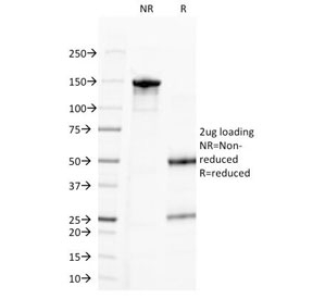 Progesterone Antibody - SDS-PAGE Analysis of Purified, BSA-Free Progesterone Antibody (clone 6-5E-3F). Confirmation of Integrity and Purity of the Antibody.