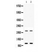 PROK1 / EG-VEGF Antibody - Western blot analysis of Prokineticin 1 expression in mouse liver extract (lane 1) and mouse spleen extract (lane 2). Prokineticin 1 at 10 kD, 23 kD was detected using rabbit anti- Prokineticin 1 Antigen Affinity purified polyclonal antibody at 0.5 ug/mL. The blot was developed using chemiluminescence (ECL) method.