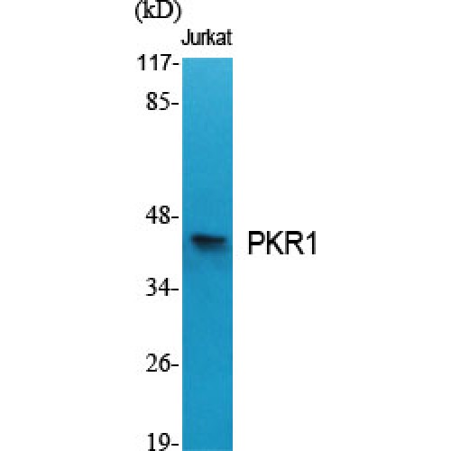 PROKR1 Antibody - Western blot of PKR1 antibody
