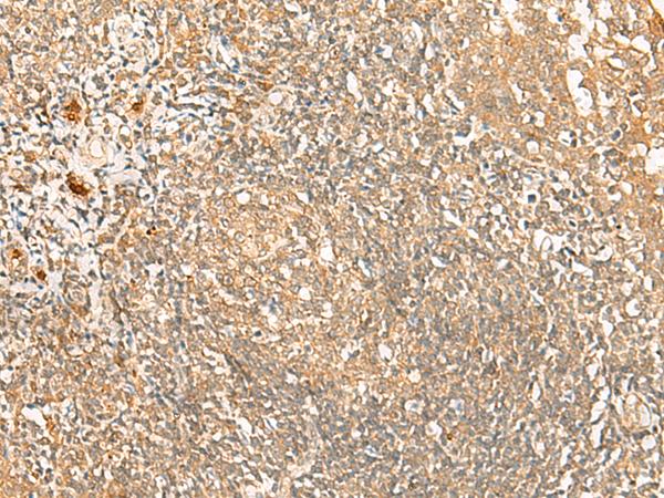 PROKR1 Antibody - Immunohistochemistry of paraffin-embedded Human tonsil tissue  using PROKR1 Polyclonal Antibody at dilution of 1:40(×200)