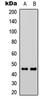 PROKR1 Antibody - Western blot analysis of GPR73a expression in Jurkat (A); Raw264.7 (B) whole cell lysates.