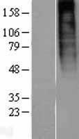 PROKR1 Protein - Western validation with an anti-DDK antibody * L: Control HEK293 lysate R: Over-expression lysate