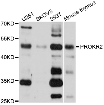 PROKR2/Prokineticin Receptor 2 Antibody - Western blot analysis of extracts of various cells.