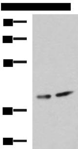 PROKR2/Prokineticin Receptor 2 Antibody - Western blot analysis of Human cerebrum tissue and Mouse brain tissue lysates  using PROKR2 Polyclonal Antibody at dilution of 1:800