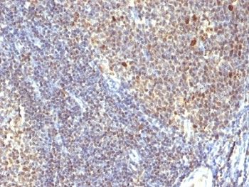 Proliferation Marker IPO-38 Antibody - Formalin-fixed, paraffin-embedded human tonsil stained with IPO38 antibody (SPM260).  This image was taken for the unmodified form of this product. Other forms have not been tested.