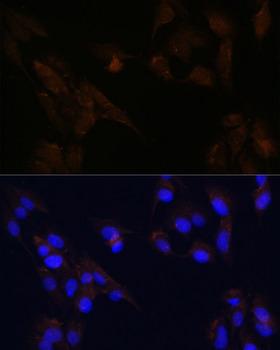 PROM1 / CD133 Antibody - Immunofluorescence analysis of C6 cells using CD133 Polyclonal Antibody at dilution of 1:100.Blue: DAPI for nuclear staining.
