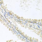 PROM1 / CD133 Antibody - Immunohistochemistry of paraffin-embedded Human prostate using CD133 Polyclonal Antibody at dilution of 1:100 (40x lens).