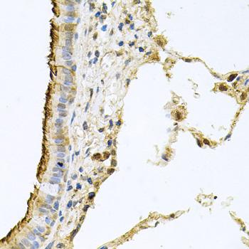 PROM1 / CD133 Antibody - Immunohistochemistry of paraffin-embedded Human lung using CD133 Polyclonal Antibody at dilution of 1:100 (40x lens).