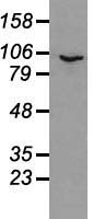 Prominin 2 / PROM2 Antibody - Western blot of 35 ug of cell extracts from human Liver carcinoma (HepG2) cells using anti-PROM2 antibody.