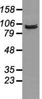 Prominin 2 / PROM2 Antibody - Western blot of 35 ug of cell extracts from human colon adenocarcinoma (HT29) cells using anti-PROM2 antibody.