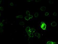 Prominin 2 / PROM2 Antibody - Immunofluorescent staining of Cos7 cells using anti-PROM2 mouse monoclonal antibody.