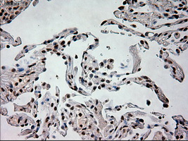 Prominin 2 / PROM2 Antibody - IHC of paraffin-embedded lung tissue using anti-PROM2 mouse monoclonal antibody. (Dilution 1:50).