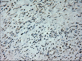 Prominin 2 / PROM2 Antibody - IHC of paraffin-embedded Ovary tissue using anti-PROM2 mouse monoclonal antibody. (Dilution 1:50).