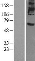 Prominin 2 / PROM2 Protein - Western validation with an anti-DDK antibody * L: Control HEK293 lysate R: Over-expression lysate