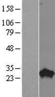 PROP1 Protein - Western validation with an anti-DDK antibody * L: Control HEK293 lysate R: Over-expression lysate