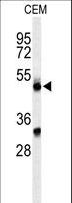 Properdin / CFP Antibody - Western blot of CFP Antibody in CEM cell line lysates (35 ug/lane). CFP (arrow) was detected using the purified antibody.