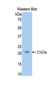 Properdin / CFP Antibody - Western blot of recombinant Properdin / CFP.  This image was taken for the unconjugated form of this product. Other forms have not been tested.