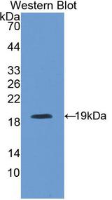 Properdin / CFP Antibody - Western Blot; Sample: Recombinant protein.