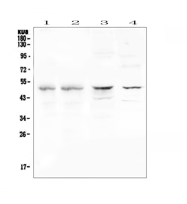 Properdin / CFP Antibody - Western blot analysis of CFP using anti-CFP antibody. Electrophoresis was performed on a 5-20% SDS-PAGE gel at 70V (Stacking gel) / 90V (Resolving gel) for 2-3 hours. The sample well of each lane was loaded with 50ug of sample under reducing conditions. Lane 1: human placenta tissue lysates,Lane 2: human U-937 whole cell lysate,Lane 3: rat brain tissue lysates,Lane 4: mouse brain tissue lysates. After Electrophoresis, proteins were transferred to a Nitrocellulose membrane at 150mA for 50-90 minutes. Blocked the membrane with 5% Non-fat Milk/ TBS for 1.5 hour at RT. The membrane was incubated with rabbit anti-CFP antigen affinity purified polyclonal antibody at 0.5 µg/mL overnight at 4°C, then washed with TBS-0.1% Tween 3 times with 5 minutes each and probed with a goat anti-rabbit IgG-HRP secondary antibody at a dilution of 1:10000 for 1.5 hour at RT. The signal is developed using an Enhanced Chemiluminescent detection (ECL) kit with Tanon 5200 system. A specific band was detected for CFP at approximately 51KD. The expected band size for CFP is at 51KD.