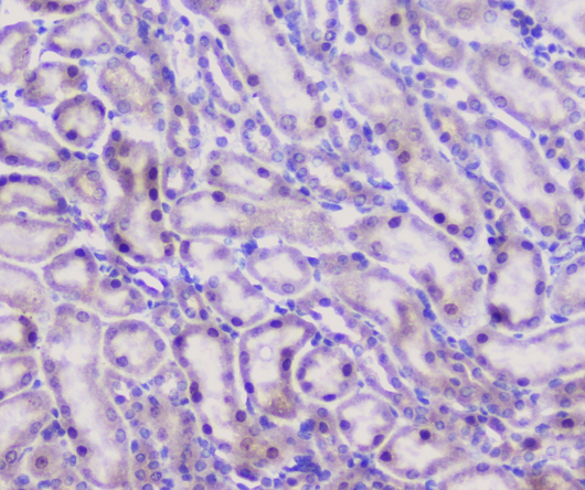 Properdin / CFP Antibody - IHC analysis of CFP using anti-CFP antibody. CFP was detected in paraffin-embedded section of mouse kidney tissue. Heat mediated antigen retrieval was performed in citrate buffer (pH6, epitope retrieval solution) for 20 mins. The tissue section was blocked with 10% goat serum. The tissue section was then incubated with 1µg/ml rabbit anti-CFP Antibody overnight at 4°C. Biotinylated goat anti-rabbit IgG was used as secondary antibody and incubated for 30 minutes at 37°C. The tissue section was developed using Strepavidin-Biotin-Complex (SABC) with DAB as the chromogen.