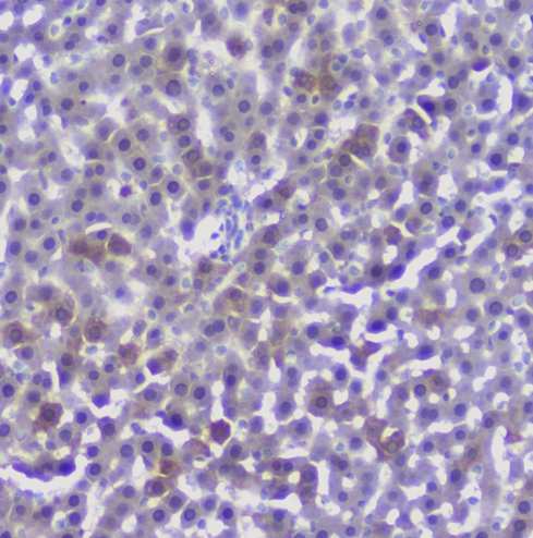 Properdin / CFP Antibody - IHC analysis of CFP using anti-CFP antibody. CFP was detected in paraffin-embedded section of rat liver tissue. Heat mediated antigen retrieval was performed in citrate buffer (pH6, epitope retrieval solution) for 20 mins. The tissue section was blocked with 10% goat serum. The tissue section was then incubated with 1µg/ml rabbit anti-CFP Antibody overnight at 4°C. Biotinylated goat anti-rabbit IgG was used as secondary antibody and incubated for 30 minutes at 37°C. The tissue section was developed using Strepavidin-Biotin-Complex (SABC) with DAB as the chromogen.