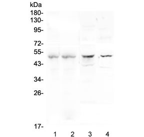 Properdin / CFP Antibody - Western blot testing of 1) human placenta, 2) human U937, 3) rat brain and 4) mouse brain lysate with Properdin antibody at 0.5ug/ml. Predicted molecular weight ~51 kDa.