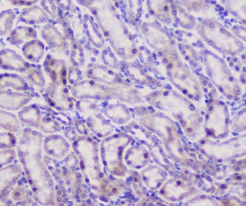 Properdin / CFP Antibody - IHC staining of FFPE mouse kidney with Properdin antibody at 1ug/ml. HIER: boil tissue sections in pH6, 10mM citrate buffer, for 10-20 min followed by cooling at RT for 20 min.
