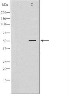 Properdin / CFP Antibody - Western blot analysis of 293T whole cells lysates using CFP antibody. The lane on the left is treated with the antigen-specific peptide.