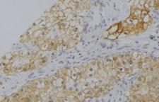 Properdin / CFP Antibody - 1:100 staining human uterus tissue by IHC-P. The sample was formaldehyde fixed and a heat mediated antigen retrieval step in citrate buffer was performed. The sample was then blocked and incubated with the antibody for 1.5 hours at 22°C. An HRP conjugated goat anti-rabbit antibody was used as the secondary.