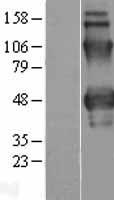 Properdin / CFP Protein - Western validation with an anti-DDK antibody * L: Control HEK293 lysate R: Over-expression lysate
