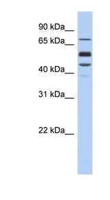 PROS1 / Protein S Antibody - PROS1 antibody Western blot of Fetal Muscle lysate. This image was taken for the unconjugated form of this product. Other forms have not been tested.