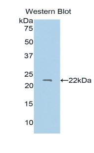 PROS1 / Protein S Antibody - Western blot of recombinant PROS1 / Protein S.  This image was taken for the unconjugated form of this product. Other forms have not been tested.