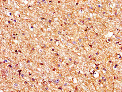 PROS1 / Protein S Antibody - IHC image of PROS1 Antibody diluted at 1:200 and staining in paraffin-embedded human brain tissue performed on a Leica BondTM system. After dewaxing and hydration, antigen retrieval was mediated by high pressure in a citrate buffer (pH 6.0). Section was blocked with 10% normal goat serum 30min at RT. Then primary antibody (1% BSA) was incubated at 4°C overnight. The primary is detected by a biotinylated secondary antibody and visualized using an HRP conjugated SP system.