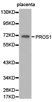 PROS1 / Protein S Antibody - Western blot of extracts of human placenta tissue, using PROS1 antibody.
