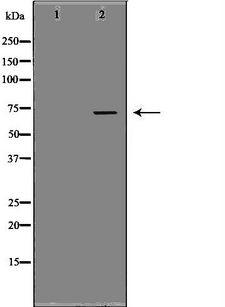 PROS1 / Protein S Antibody - Western blot analysis of extracts of human placenta tissue using PROS1 antibody. The lane on the left is treated with the antigen-specific peptide.