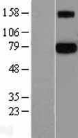 PROS1 / Protein S Protein - Western validation with an anti-DDK antibody * L: Control HEK293 lysate R: Over-expression lysate