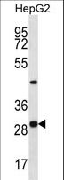 PROSC Antibody - PROSC Antibody western blot of HepG2 cell line lysates (35 ug/lane). The PROSC antibody detected the PROSC protein (arrow).