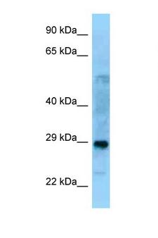 PROSC Antibody - PROSC antibody Western blot of Fetal Lung lysate. Antibody concentration 1 ug/ml.  This image was taken for the unconjugated form of this product. Other forms have not been tested.