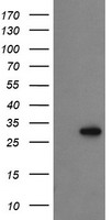 PROSC Antibody - HEK293T cells were transfected with the pCMV6-ENTRY control (Left lane) or pCMV6-ENTRY PROSC (Right lane) cDNA for 48 hrs and lysed. Equivalent amounts of cell lysates (5 ug per lane) were separated by SDS-PAGE and immunoblotted with anti-PROSC.