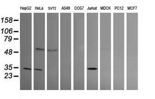 PROSC Antibody - Western blot of extracts (35 ug) from 9 different cell lines by using g anti-PROSC monoclonal antibody (HepG2: human; HeLa: human; SVT2: mouse; A549: human; COS7: monkey; Jurkat: human; MDCK: canine; PC12: rat; MCF7: human).
