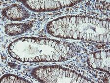 PROSC Antibody - IHC of paraffin-embedded Human colon tissue using anti-PROSC mouse monoclonal antibody.