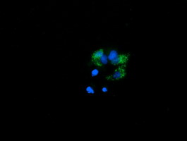 PROSC Antibody - Anti-PROSC mouse monoclonal antibody immunofluorescent staining of COS7 cells transiently transfected by pCMV6-ENTRY PROSC.