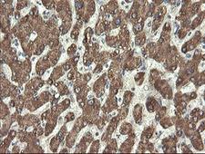 PROSC Antibody - IHC of paraffin-embedded Human liver tissue using anti-PROSC mouse monoclonal antibody.