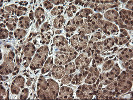 PROSC Antibody - IHC of paraffin-embedded Human pancreas tissue using anti-PROSC mouse monoclonal antibody.