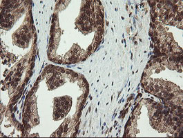 PROSC Antibody - IHC of paraffin-embedded Human prostate tissue using anti-PROSC mouse monoclonal antibody.
