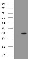 PROSC Antibody - HEK293T cells were transfected with the pCMV6-ENTRY control (Left lane) or pCMV6-ENTRY PROSC (Right lane) cDNA for 48 hrs and lysed. Equivalent amounts of cell lysates (5 ug per lane) were separated by SDS-PAGE and immunoblotted with anti-PROSC.