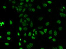 PROSER1 / C13orf23 Antibody - Immunofluorescence staining of PROSER1 in Caco2 cells. Cells were fixed with 4% PFA, permeabilzed with 0.3% Triton X-100 in PBS, blocked with 10% serum, and incubated with rabbit anti-Human PROSER1 polyclonal antibody (dilution ratio 1:200) at 4°C overnight. Then cells were stained with the Alexa Fluor 488-conjugated Goat Anti-rabbit IgG secondary antibody (green). Positive staining was localized to Nucleus.