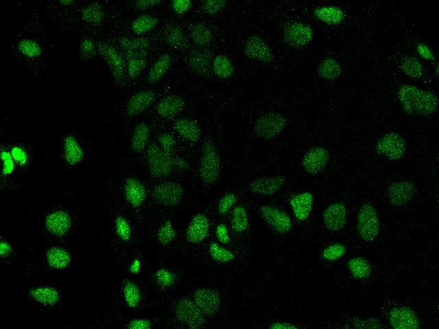 PROSER1 / C13orf23 Antibody - Immunofluorescence staining of PROSER1 in Caco2 cells. Cells were fixed with 4% PFA, permeabilzed with 0.3% Triton X-100 in PBS, blocked with 10% serum, and incubated with rabbit anti-Human PROSER1 polyclonal antibody (dilution ratio 1:200) at 4°C overnight. Then cells were stained with the Alexa Fluor 488-conjugated Goat Anti-rabbit IgG secondary antibody (green). Positive staining was localized to Nucleus.