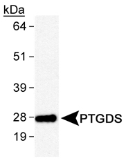 Prostaglandin D Synthase Antibody - Detection of PTGDS in human brain lysates with primary antibody at 2.0 ug/ml.  This image was taken for the unconjugated form of this product. Other forms have not been tested.